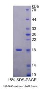 Human Ubiquitin A 52 Residue Ribosomal Protein Fusion Product 1 (UBA52) Protein
