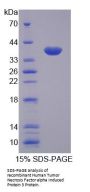 Human Tumor Necrosis Factor Alpha Induced Protein 3 (TNFaIP3) Protein