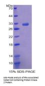 Human Rho-Associated Protein Kinase 2 (ROCK2) Protein
