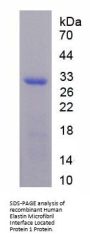 Human Elastin Microfibril Interfacer 1 (EMILIN1) Protein