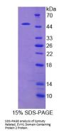 Human Sprouty Related, EVH1 Domain Containing Protein 2 (SPRED2) Protein