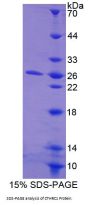 Human Collagen Triple Helix Repeat Containing Protein 1 (CTHRC1) Protein