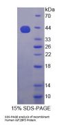 Human Insulin Like Growth Factor 2 mRNA Binding Protein 3 (IGF2BP3) Protein