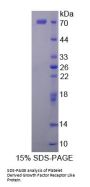 Human Platelet Derived Growth Factor Receptor Like Protein (PDGFRL) Protein