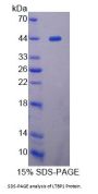 Human Latent Transforming Growth Factor Beta Binding Protein 1 (LTBP1) Protein