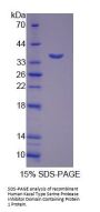 Human Kazal Type Serine Protease Inhibitor Domain Containing Protein 1 (KAZALD1) Protein