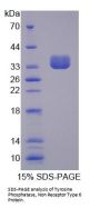 Human Protein Tyrosine Phosphatase, Non Receptor Type 6 (PTPN6) Protein