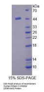 Human Protein C Inhibitor (SERPINA5) Protein