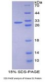 Human Protein Kinase D1 (PKD1) Protein