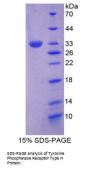 Human Protein Tyrosine Phosphatase Receptor Type H (PTPRH) Protein