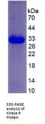 Human Protein Kinase R (PKR) Protein