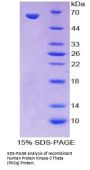 Human Protein Kinase C Theta (PKCq) Protein