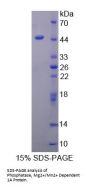Human Protein Phosphatase, Mg2+/Mn2+ Dependent 1A (PPM1A) Protein
