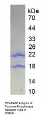 Human Protein Tyrosine Phosphatase Receptor Type N (PTPRN) Protein