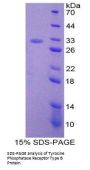 Mouse Protein Tyrosine Phosphatase Receptor Type B (PTPRB) Protein