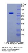 Mouse Protein Tyrosine Phosphatase Receptor Type J (PTPRJ) Protein