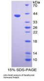 Cow Parathyroid Hormone (PTH) Protein