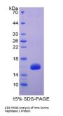 E. coli HtrA Serine Peptidase 1 (HTRA1) Protein