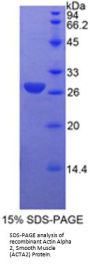 Actin Alpha 2, Smooth Muscle (ACTA2) Protein