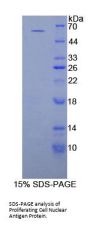 Proliferating Cell Nuclear Antigen (PCNA) Protein