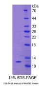 Horse Regulated On Activation In Normal T-Cell Expressed And Secreted (RANTES) Protein