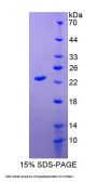 Horse Apolipoprotein M (APOM) Protein