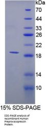 Human Vasopressin-Neurophysin 2-Copeptin (AVP) Protein