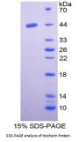 Human Nischarin (NISCH) Protein