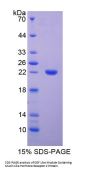 Human EGF Like Module Containing Mucin Like Hormone Receptor 2 (EMR2) Protein