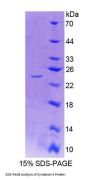 Human Syndecan 4 (SDC4) Protein