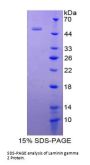 Human Laminin Gamma 2 (LAMC2) Protein
