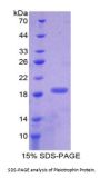 Human Pleiotrophin (PTN) Protein