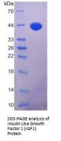 Human Insulin Like Growth Factor 1 (IGF1) Protein