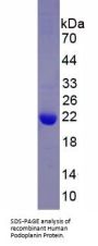 Human Podoplanin (PDPN) Protein