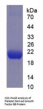 Human Platelet Derived Growth Factor BB (PDGFBB) Protein