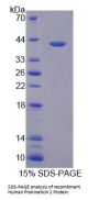 Human Prokineticin 2 / PK2 (PROK2) Protein