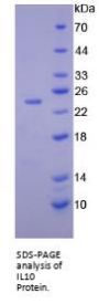 Human Interleukin 10 (IL10) Protein