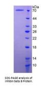 Human Inhibin Beta B (INHbB) Protein