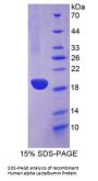 Human Alpha Lactalbumin (LALBA) Protein