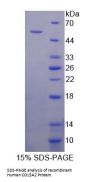 Human Collagen Type V Alpha 2 (COL5A2) Protein
