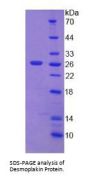 Human Desmoplakin (DSP) Protein