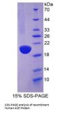 Human Angiotensin I Converting Enzyme (ACE) Protein