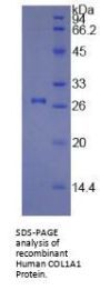 Human Collagen Type I Alpha 1 (COL1A1) Protein
