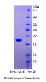 Human Frataxin (FXN) Protein