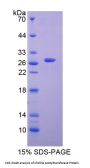 Human Choline Acetyltransferase (ChAT) Protein