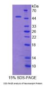 Human Neuroserpin (NSP) Protein