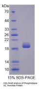 Human Phospholipase A2 (PLA2G1B) Protein