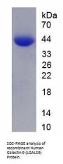 Human Galectin 9 (LGALS9) Protein