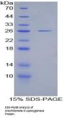 Human Polyunsaturated Fatty Acid 5-Lipoxygenase (ALOX5) Protein