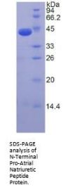 Human N-Terminal Pro-Atrial Natriuretic Peptide (NT-ProANP) Protein